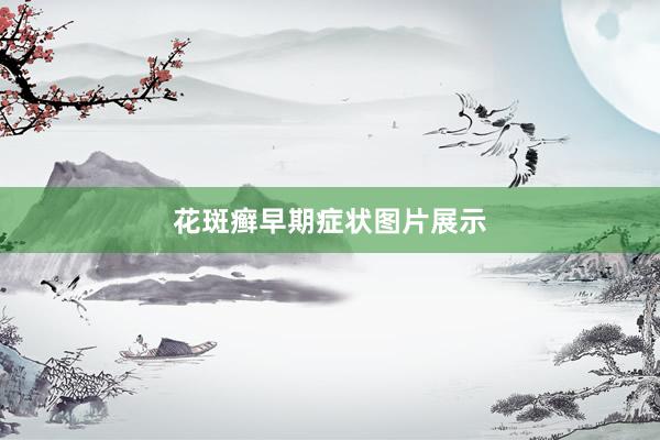 花斑癣早期症状图片展示